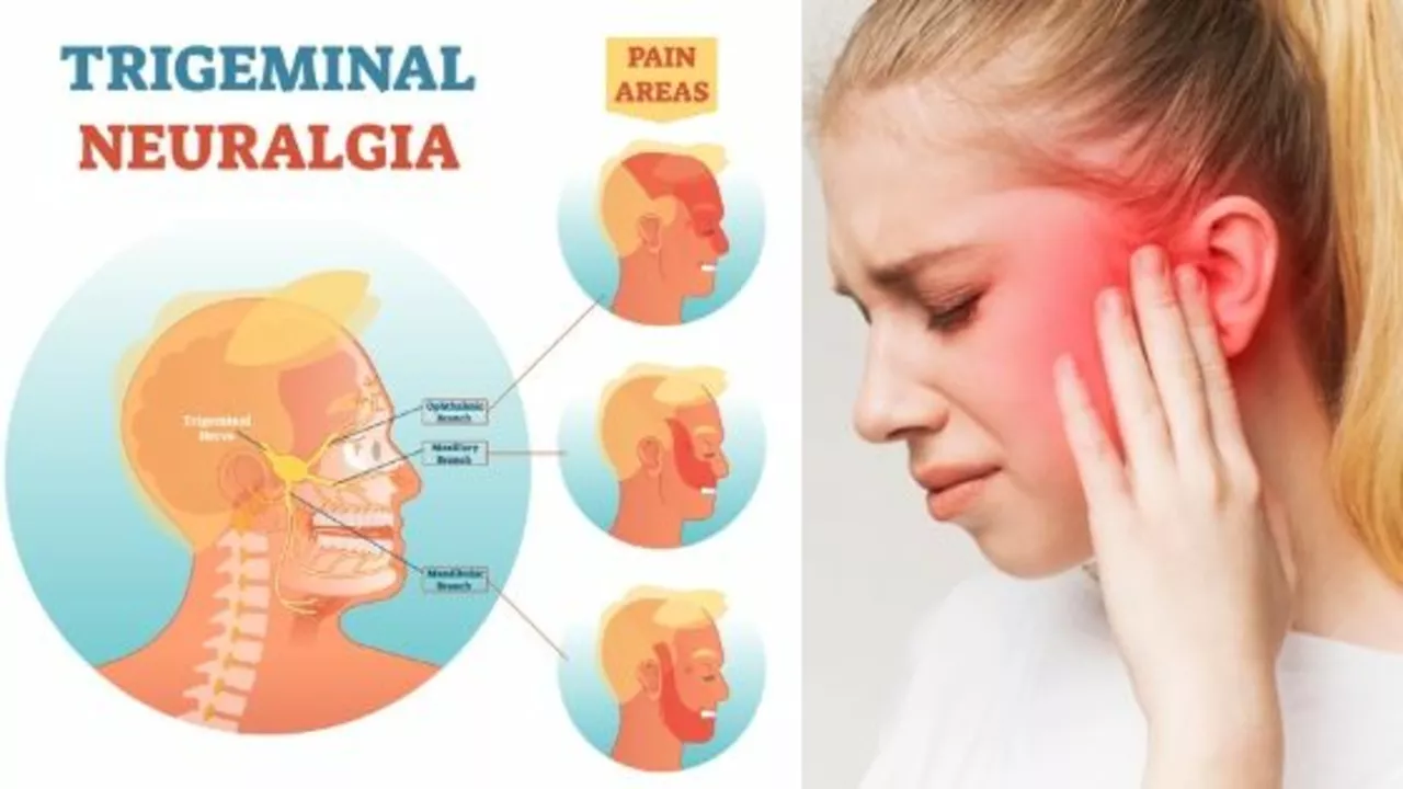 The Role of Amitriptyline in Treating Trigeminal Neuralgia